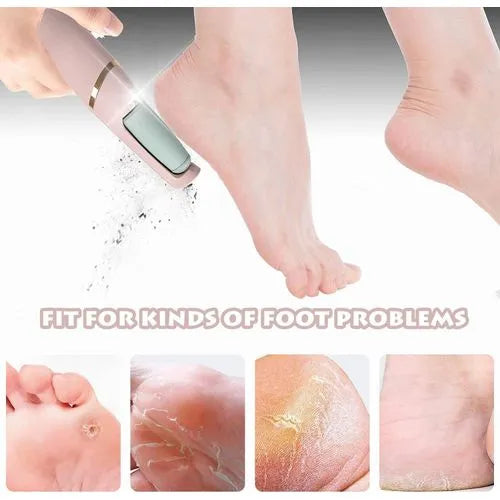 Flawless Electric Foot Callus Remover